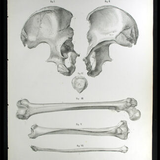 Erdl, M(ichael) P(ius) (1815-1848): - Knochenlehre.