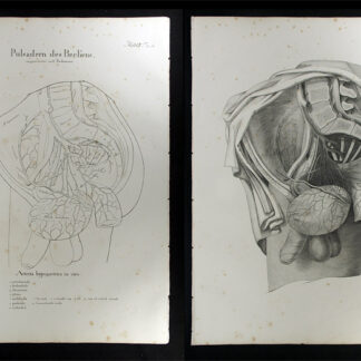 Oesterreicher, Johann Heinrich (1805-1843): - Pulsadern des Beckens - Arteria hypogastrica in viro.