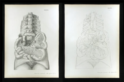 Erdl, M(ichael) P(ius) (1815-1848): - Gefässlehre.