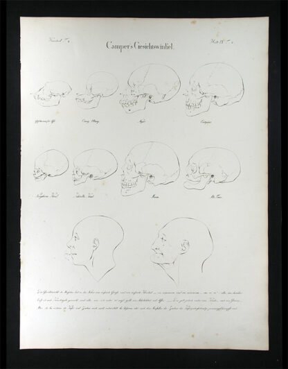 Oesterreicher, Johann Heinrich (1805-1843): - Camper's Gesichtswinkel.