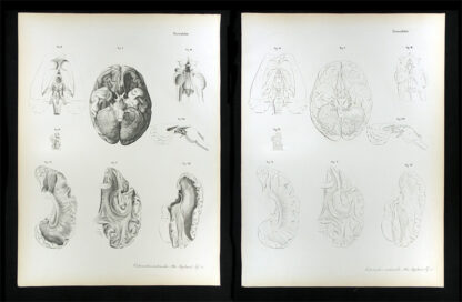 Erdl, M(ichael) P(ius) (1815-1848): - Nervenlehre.