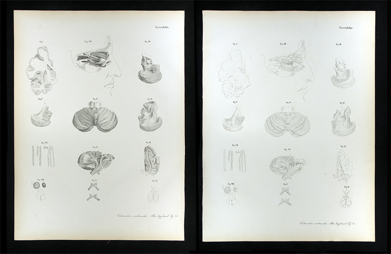 Erdl, M(ichael) P(ius) (1815-1848): - Nervenlehre.