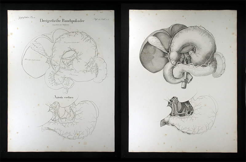 Oesterreicher, Johann Heinrich (1805-1843): - Dreigetheilte Bauchpulsader.