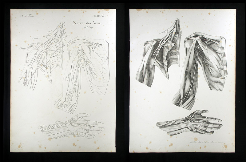 Oesterreicher, Johann Heinrich (1805-1843): - Nerven des Arms.