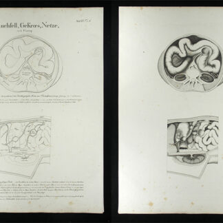 Oesterreicher, Johann Heinrich (1805-1843): - Bauchfell, Gekroes, Netze.