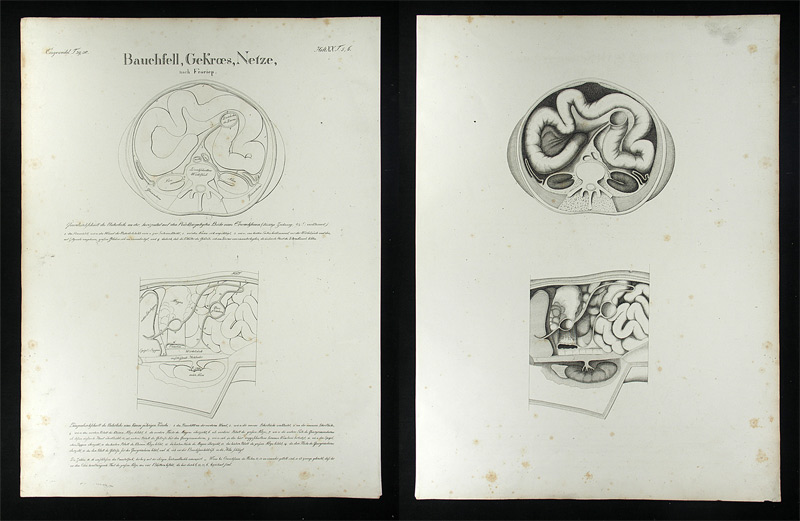 Oesterreicher, Johann Heinrich (1805-1843): - Bauchfell, Gekroes, Netze.