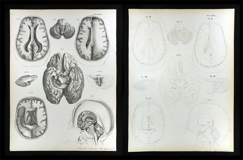Erdl, M(ichael) P(ius) (1815-1848): - Nervenlehre.