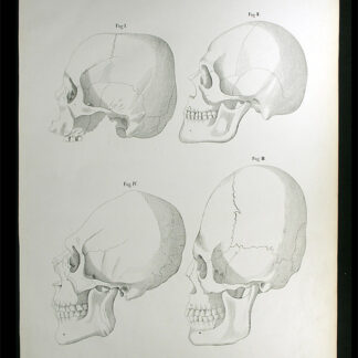 Erdl, M(ichael) P(ius) (1815-1848): - Knochenlehre.