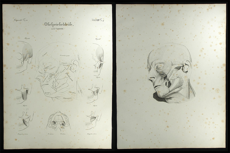Oesterreicher, Johann Heinrich (1805-1843): - Ohrspeicheldrüse.