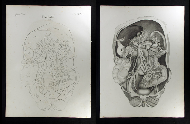 Oesterreicher, Johann Heinrich (1805-1843): - Pfortader.