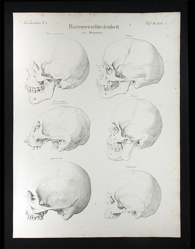 Oesterreicher, Johann Heinrich (1805-1843): - Racenverschiedenheit.