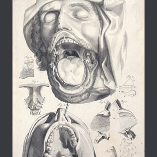 Manget, Jean Jacques: (1652-1742): - Theatrum anatomicum (...) Tafel CVIII.
