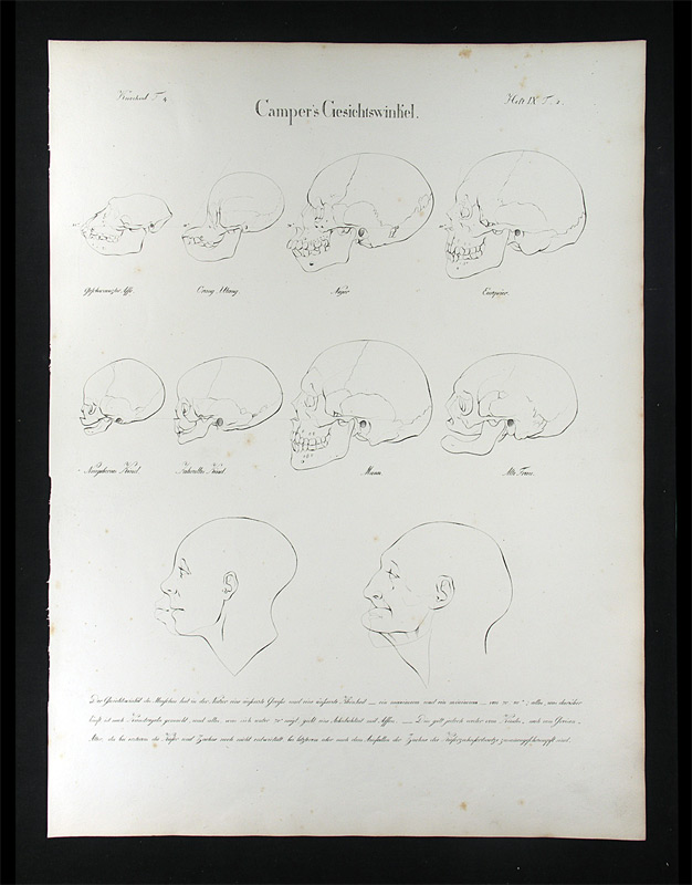 Oesterreicher, Johann Heinrich (1805-1843): - Camper's Gesichtswinkel.