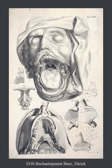 Manget, Jean Jacques: (1652-1742): - Theatrum anatomicum (...) Tafel CVIII.