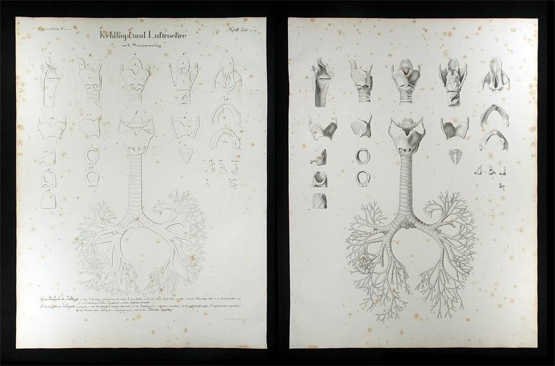 Oesterreicher, Johann Heinrich (1805-1843): - Kehlkopf und Luftröhre.